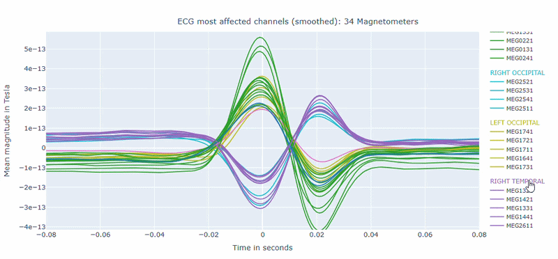 MEEGqc ECG affected channel report